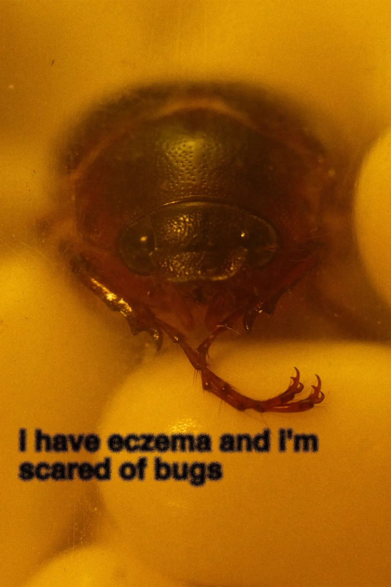 Постер к фильму "i have eczema and i
