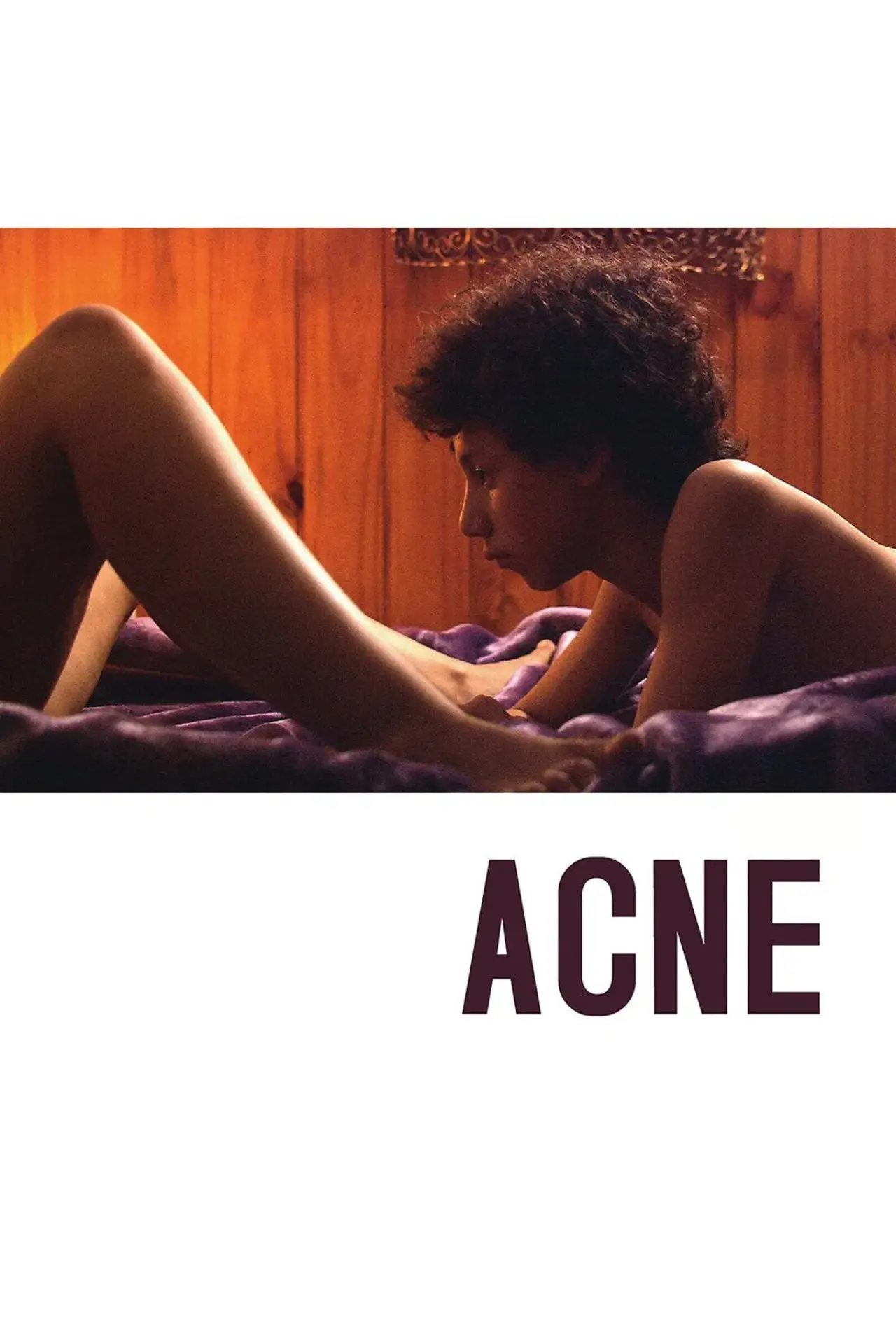 Постер к фильму "Acné"