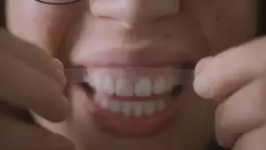 Задник к фильму "Des dents blanches... au rire jaune !" #774158