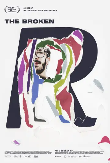 Rotacismo