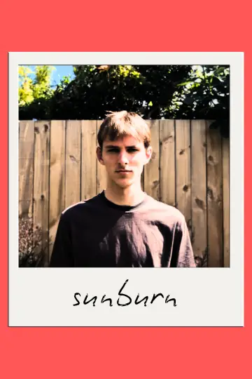 Sunburn
