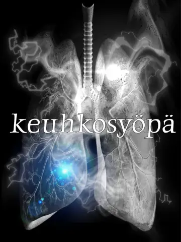 Постер к фильму "keuhkosyöpä" #1184671