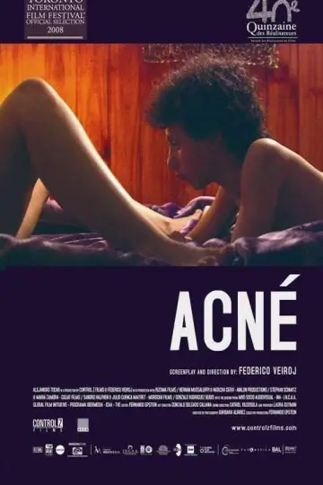 Постер к фильму "Acné" #1171126