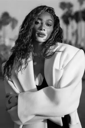 Фото Винни Харлоу (Winnie Harlow) #155995