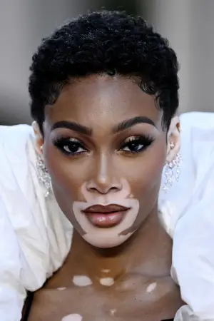 Фото Винни Харлоу (Winnie Harlow) #330233