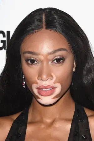 Фото Винни Харлоу (Winnie Harlow) #330232