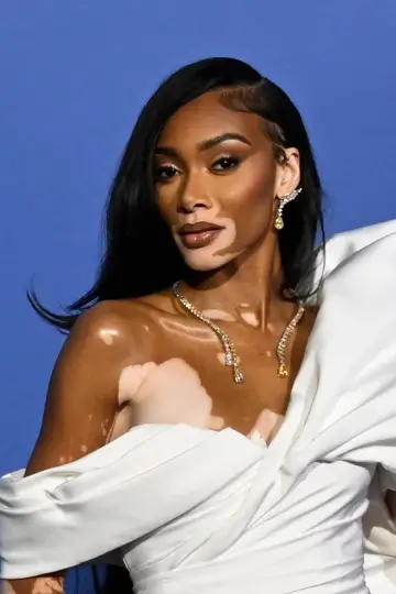 Фото Винни Харлоу (Winnie Harlow) #155993