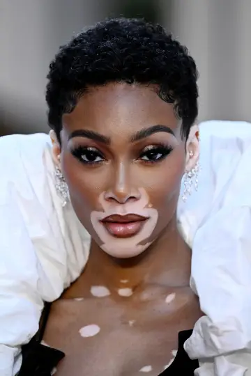 Фото Винни Харлоу (Winnie Harlow) #330231