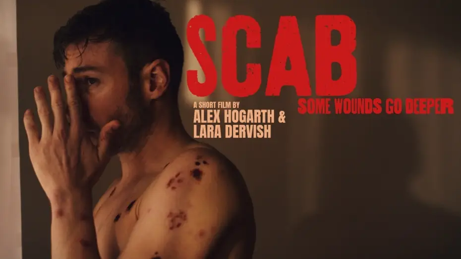 Видео к фильму Scab — SCAB | Official Teaser | Body Horror