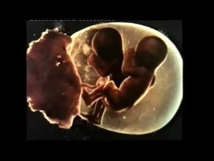 Видео к фильму Сестры — Sisters (1973) - Trailer