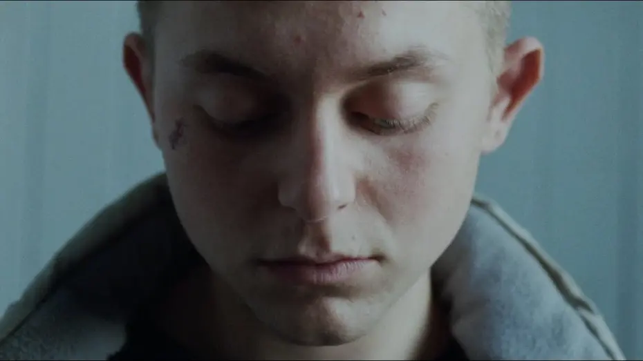 Видео к фильму Skunk | Skunk - Official Trailer