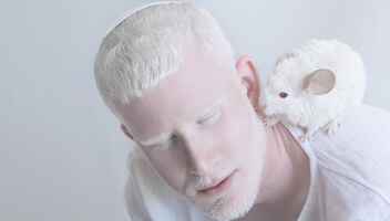 Парень- Альбинос для съемок в фильме.