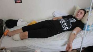 Мужчины-инвалиды, 20-25 лет, несколько съемочных дней.