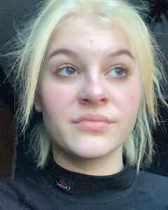 Греете Уйок Раздражение