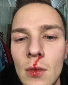 Денис Носов Слёзы