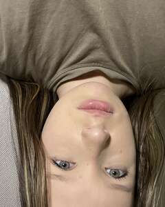 София  Раздражение