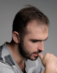 Александр Витранюк Задумчивость