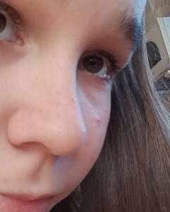 Anna Gulko Раздражение